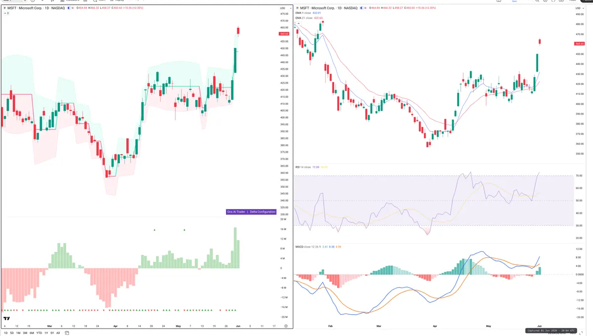 MSFT — Delta + Technical