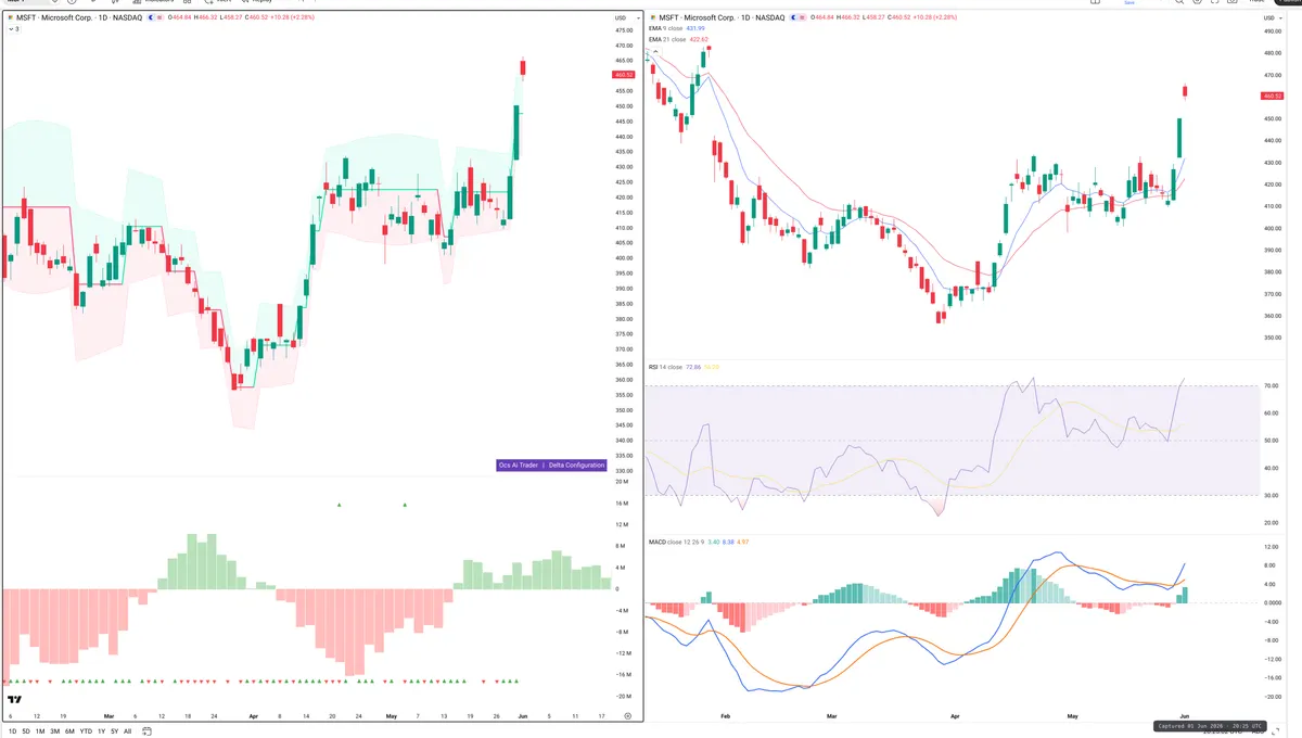 MSFT — Delta + Technical