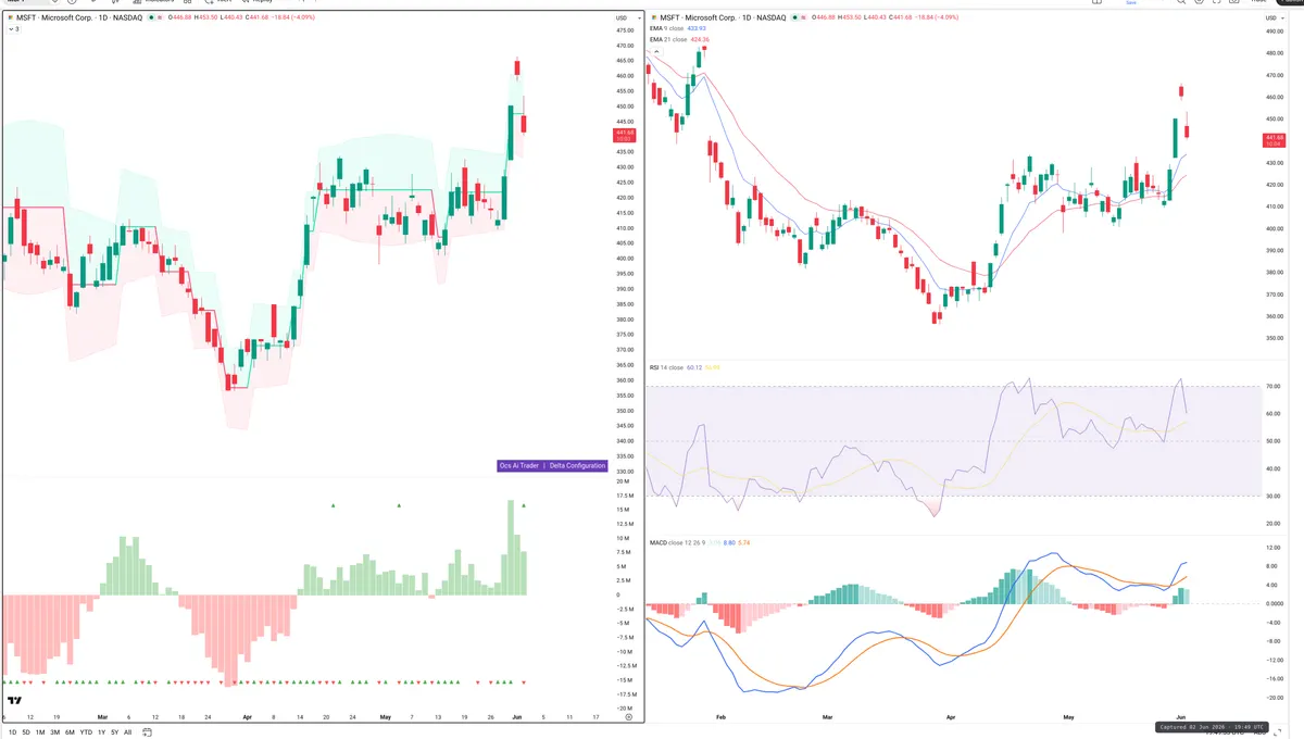 MSFT — Delta + Technical