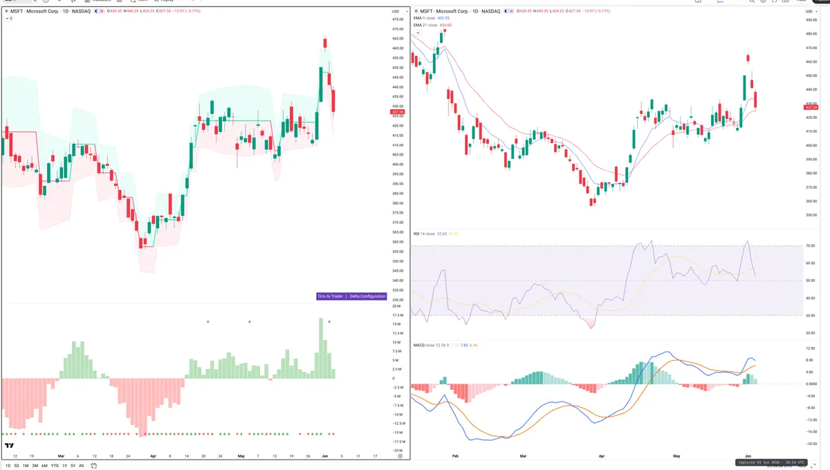 MSFT — Delta + Technical