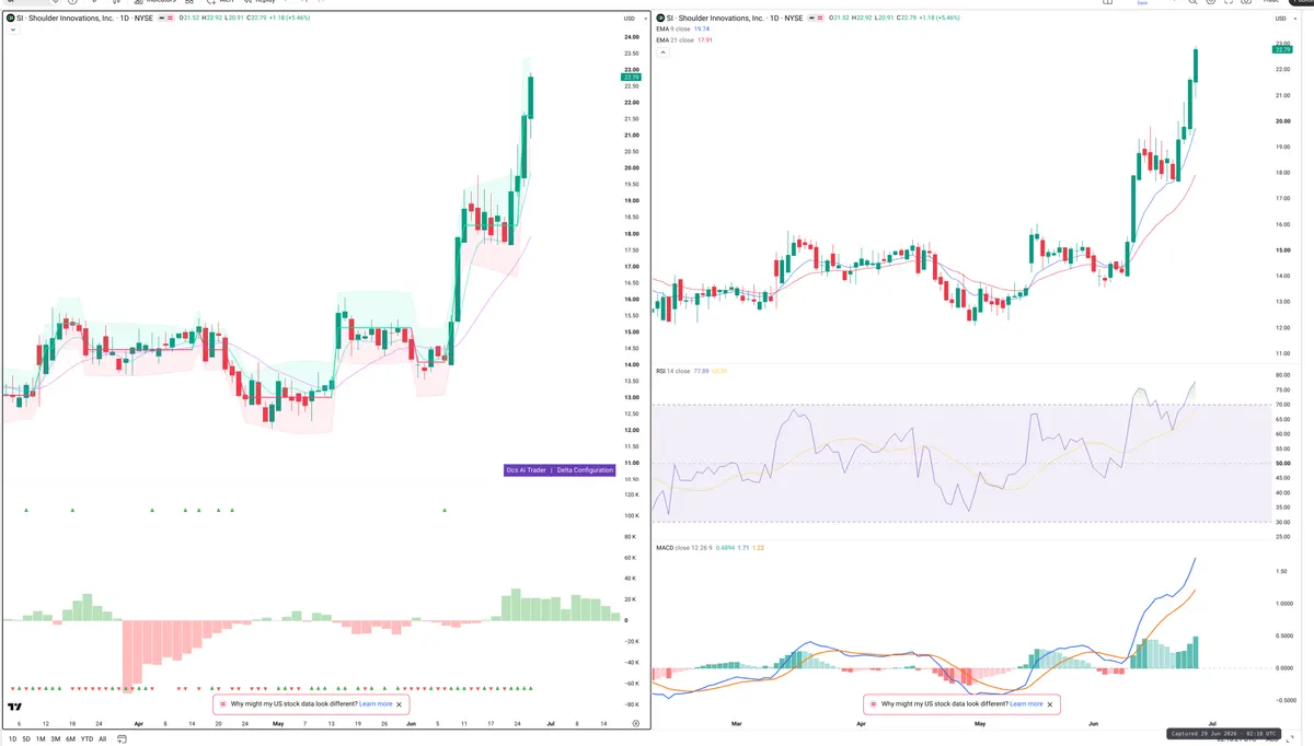SI — Delta + Technical